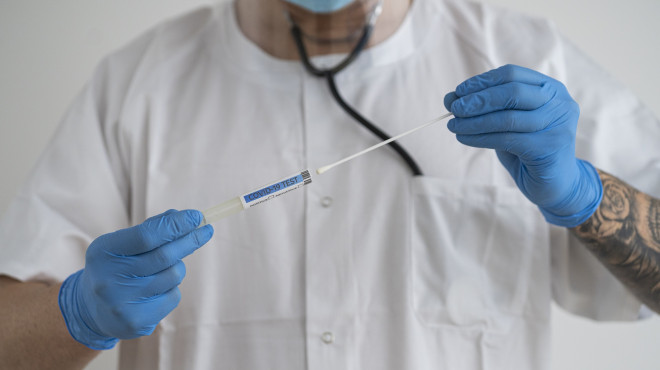 Doktor mit Abstrich für Coronauntersuchung