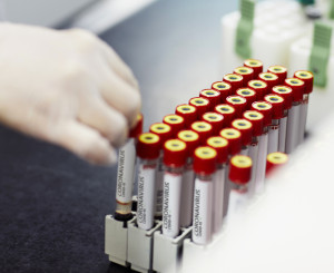 Hand eines Laboranten setzt Ampullen mit Aufschrift "Coronavirus" in Halterung